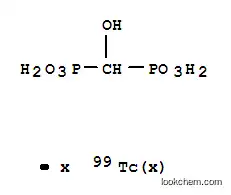 테크네튬 Tc 99m 히드록시메틸렌 디포스포네이트