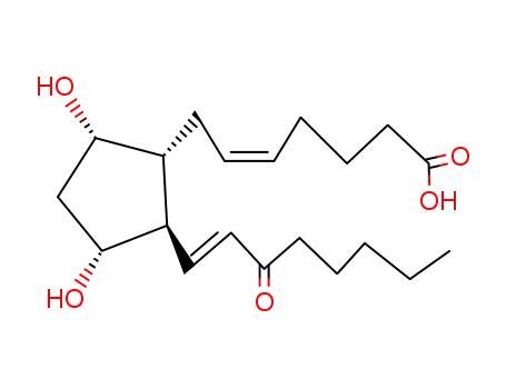 Molecular Structure of 35850-13-6 (15-KETO PROSTAGLANDIN F2ALPHA)