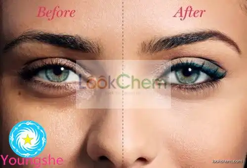 Eye bags and eye care acetyl tetrapeptide-5 eyeseryl powder