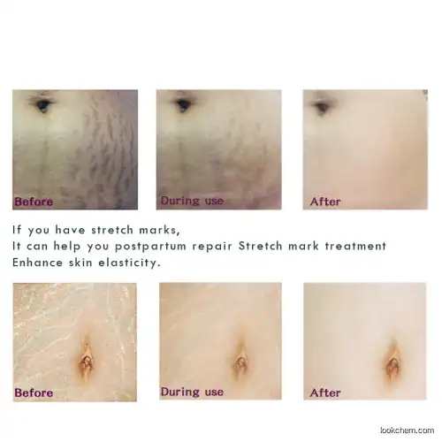 Strech Marks Removal Peptide 98.0% Purity Vanistryl Free Shipping